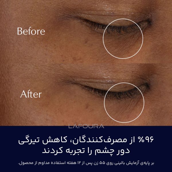کرم دور چشم ادونس نایت ریپیر استی لودر - Image 3
